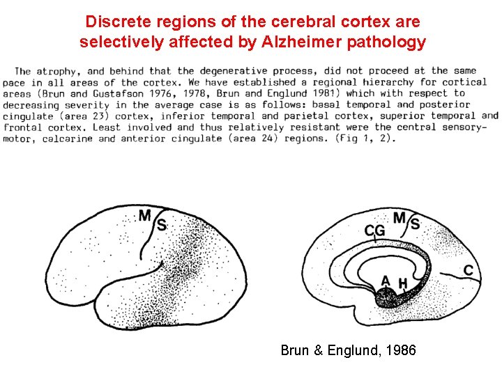 Discrete regions of the cerebral cortex are selectively affected by Alzheimer pathology Brun &