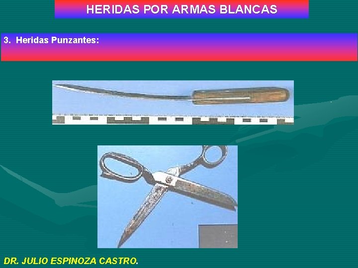 HERIDAS POR ARMAS BLANCAS 3. Heridas Punzantes: DR. JULIO ESPINOZA CASTRO. 