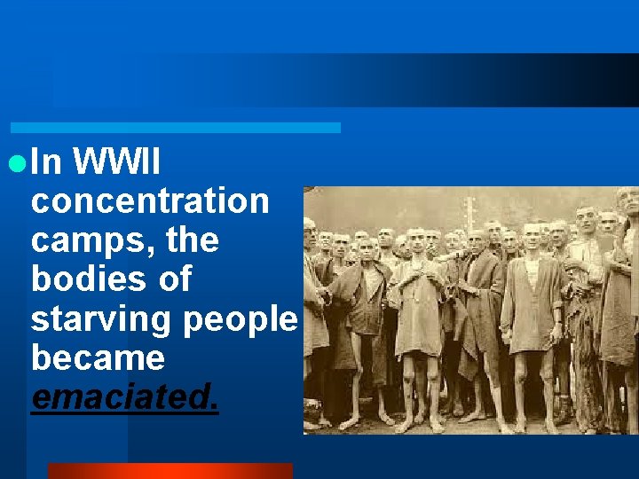 l In WWII concentration camps, the bodies of starving people became emaciated. 