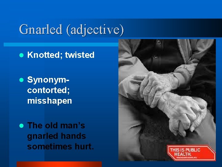 Gnarled (adjective) l Knotted; twisted l Synonymcontorted; misshapen l The old man’s gnarled hands
