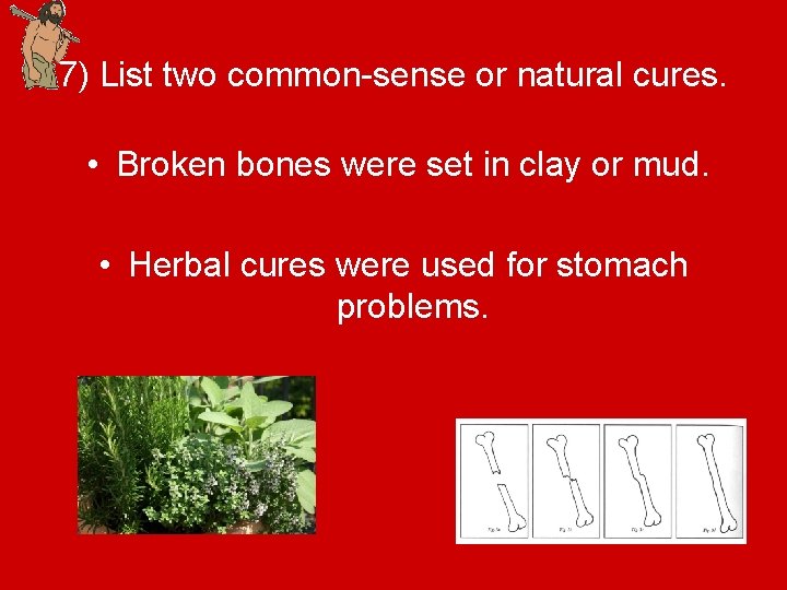 7) List two common-sense or natural cures. • Broken bones were set in clay