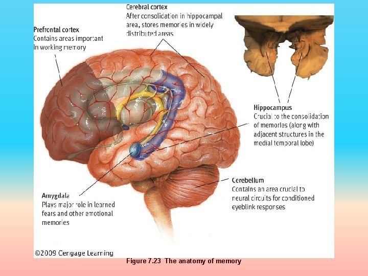 Figure 7. 23 The anatomy of memory 