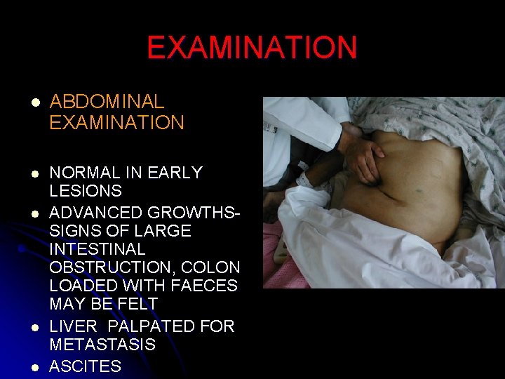 EXAMINATION l ABDOMINAL EXAMINATION l NORMAL IN EARLY LESIONS ADVANCED GROWTHSSIGNS OF LARGE INTESTINAL