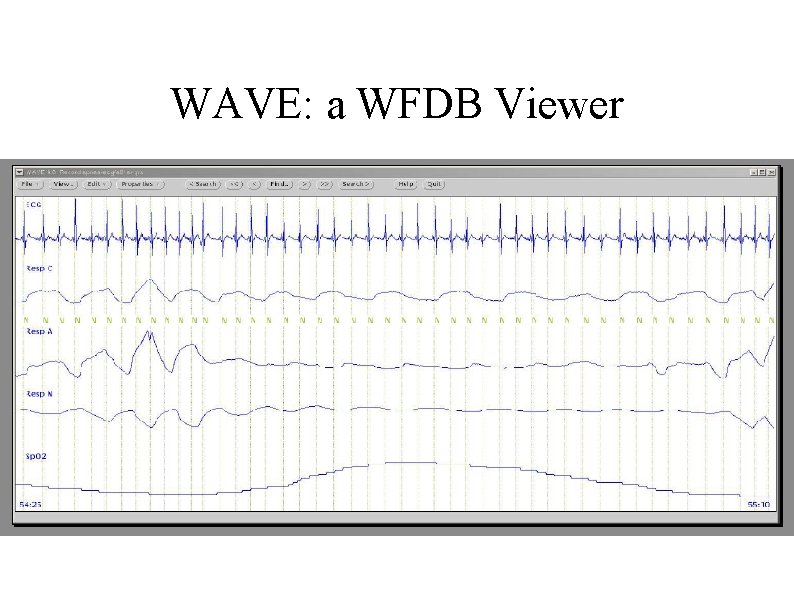 WAVE: a WFDB Viewer 