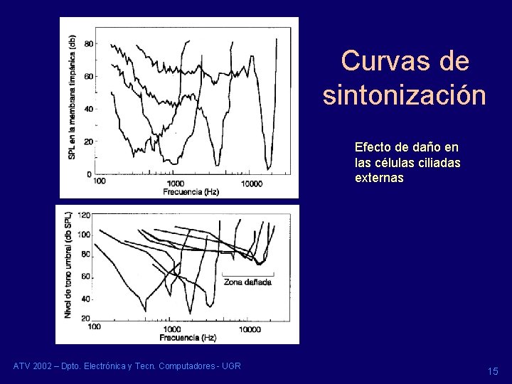 Curvas de sintonización Efecto de daño en las células ciliadas externas ATV 2002 –