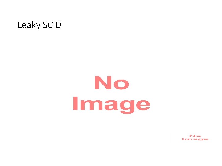 Leaky SCID 