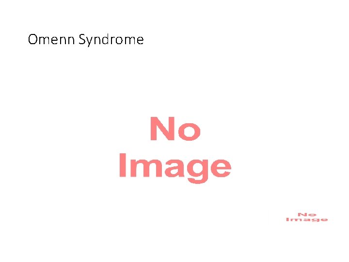 Omenn Syndrome 