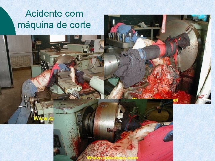 Acidente com máquina de corte 