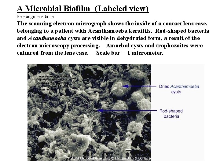 A Microbial Biofilm (Labeled view) lib. jiangnan. edu. cn The scanning electron micrograph shows