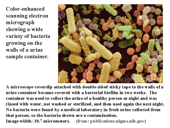 Color-enhanced scanning electron micrograph showing a wide variety of bacteria growing on the walls