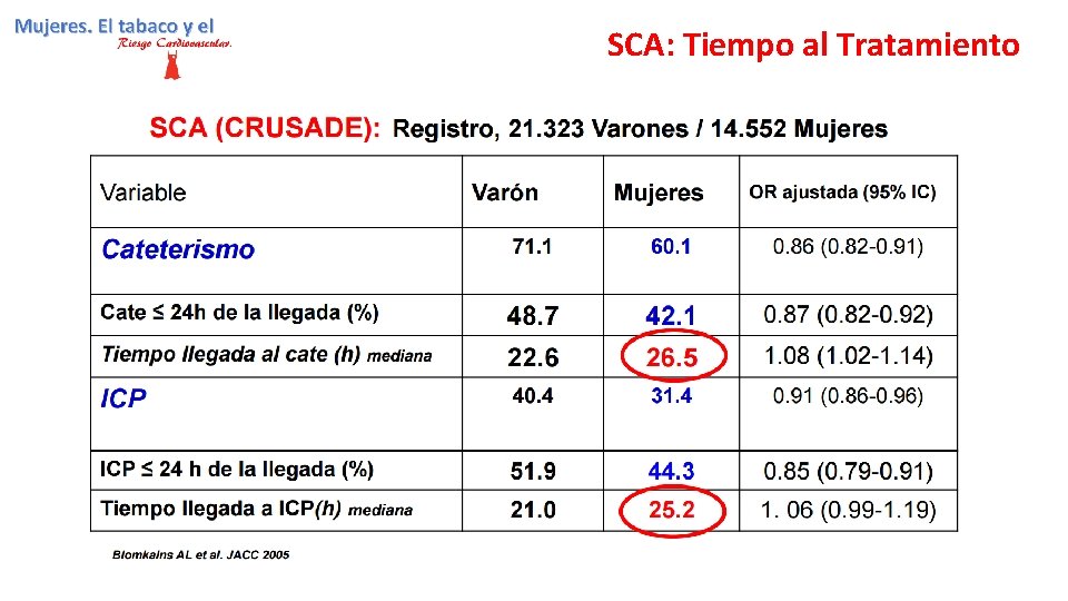 SCA: Tiempo al Tratamiento 