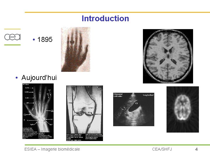 Introduction • 1895 • Aujourd’hui ESIEA – Imagerie biomédicale CEA/SHFJ 4 