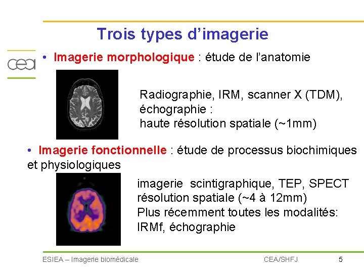 Trois types d’imagerie • Imagerie morphologique : étude de l’anatomie Radiographie, IRM, scanner X