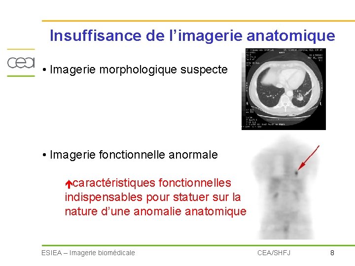 Insuffisance de l’imagerie anatomique • Imagerie morphologique suspecte • Imagerie fonctionnelle anormale é caractéristiques