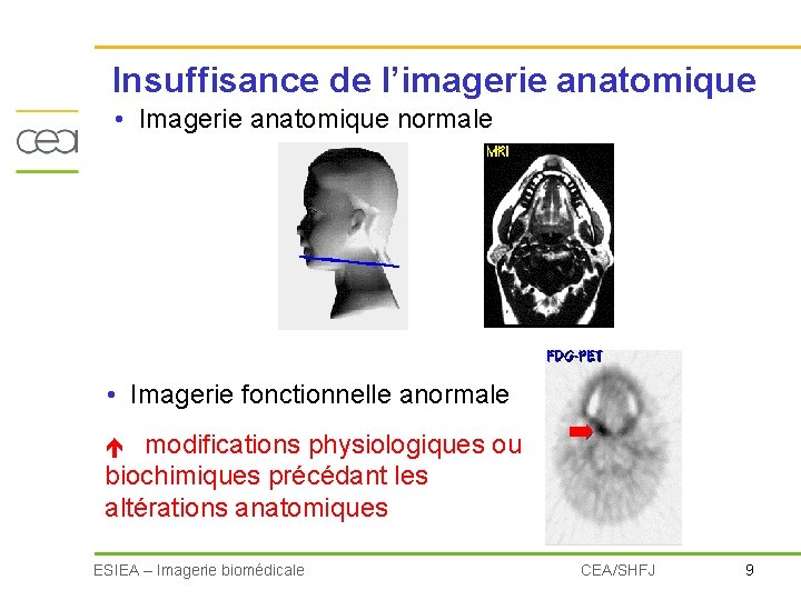 Insuffisance de l’imagerie anatomique • Imagerie anatomique normale • Imagerie fonctionnelle anormale modifications physiologiques