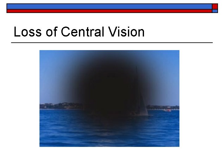 Loss of Central Vision 