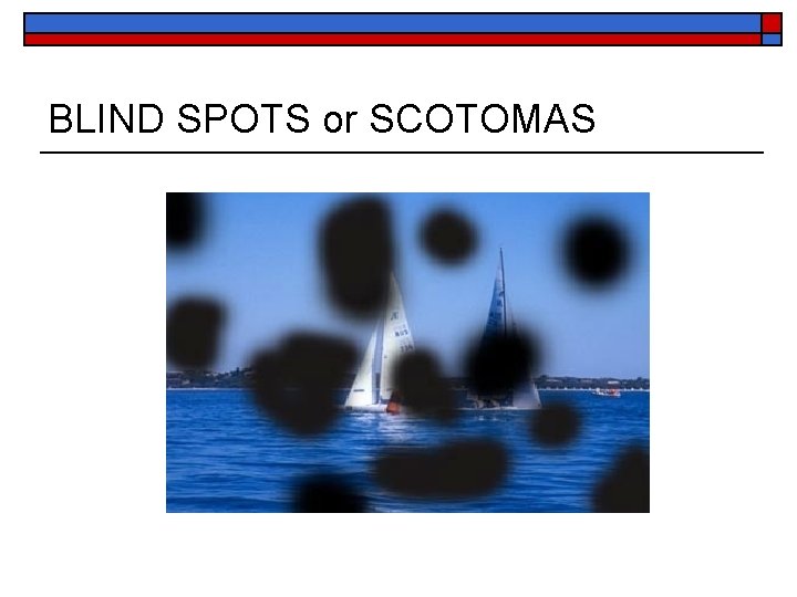 BLIND SPOTS or SCOTOMAS 