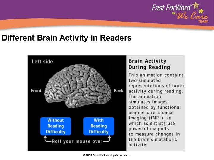 Different Brain Activity in Readers © 2005 Scientific Learning Corporation 