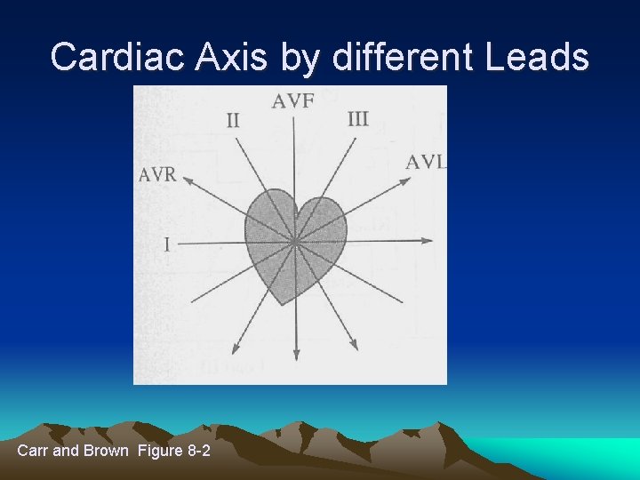 Cardiac Axis by different Leads Carr and Brown Figure 8 -2 