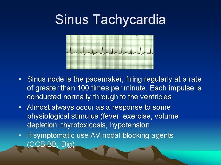 Sinus Tachycardia • Sinus node is the pacemaker, firing regularly at a rate of