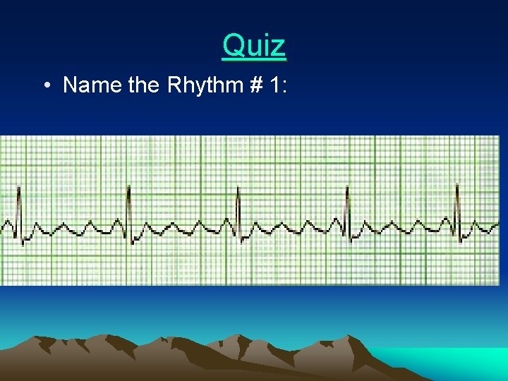 Quiz • Name the Rhythm # 1: 