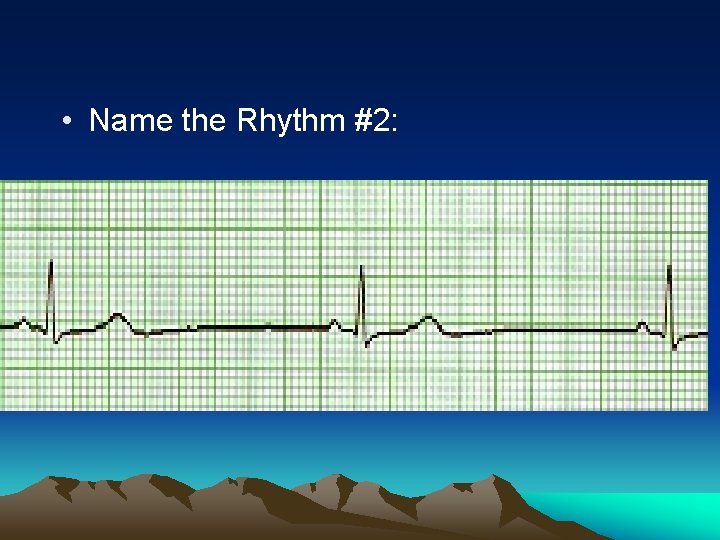  • Name the Rhythm #2: 