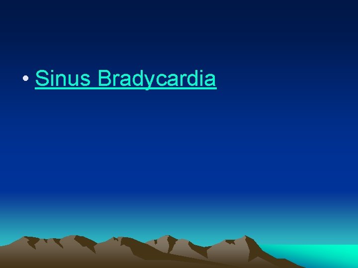  • Sinus Bradycardia 