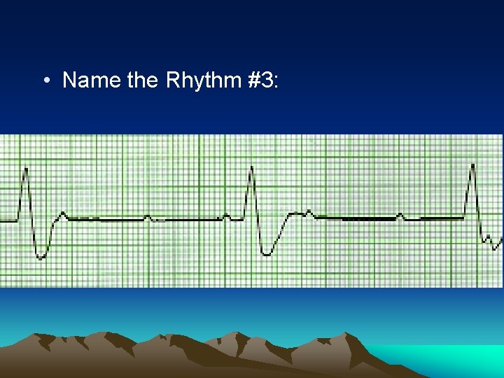  • Name the Rhythm #3: 