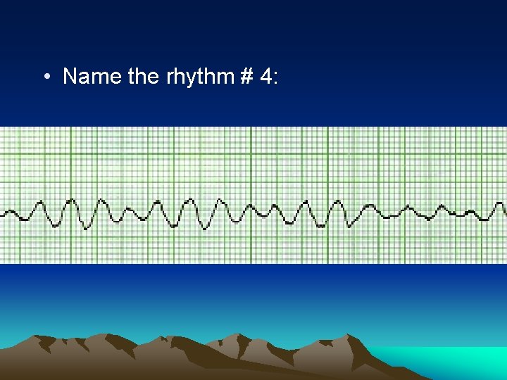  • Name the rhythm # 4: 