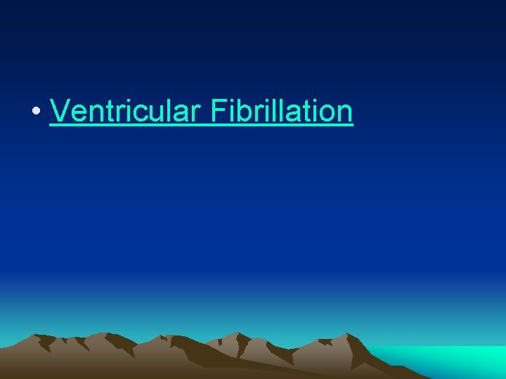  • Ventricular Fibrillation 