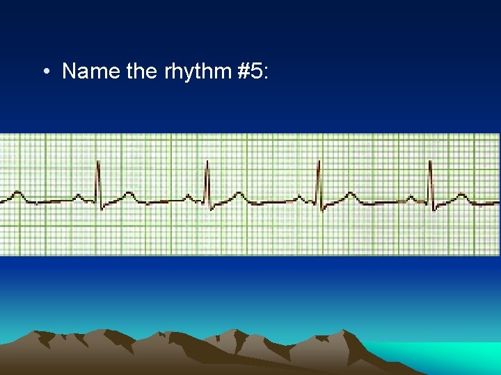  • Name the rhythm #5: 