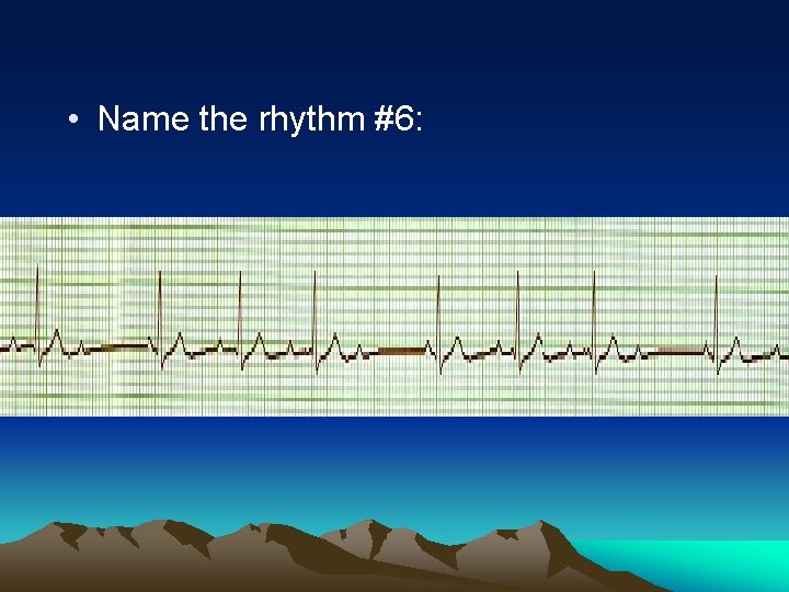  • Name the rhythm #6: 