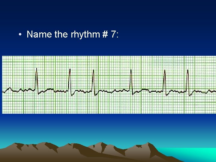  • Name the rhythm # 7: 