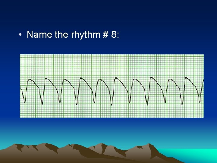  • Name the rhythm # 8: 