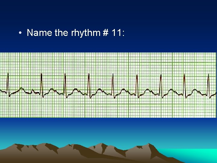  • Name the rhythm # 11: 