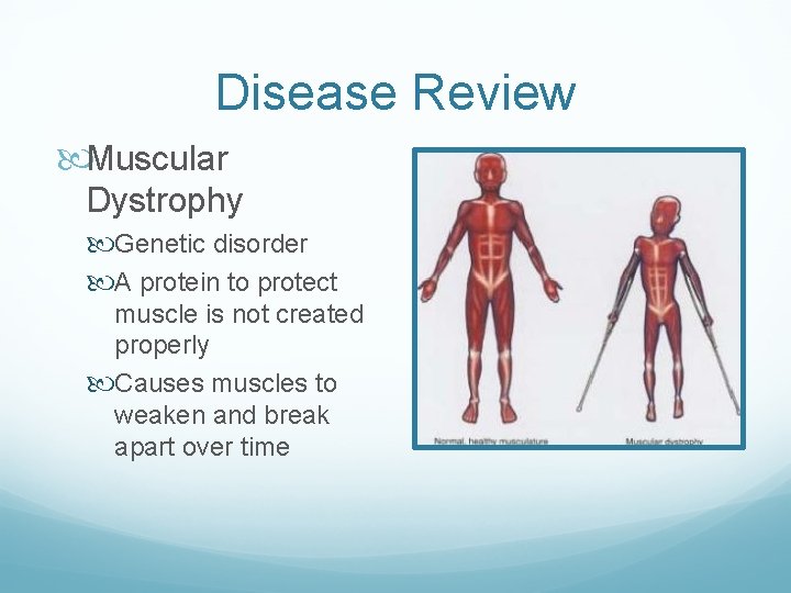 Disease Review Muscular Dystrophy Genetic disorder A protein to protect muscle is not created
