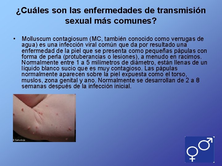 ¿Cuáles son las enfermedades de transmisión sexual más comunes? • Molluscum contagiosum (MC, también
