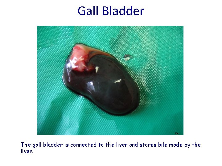 Gall Bladder Dar The gall bladder is connected to the liver and stores bile