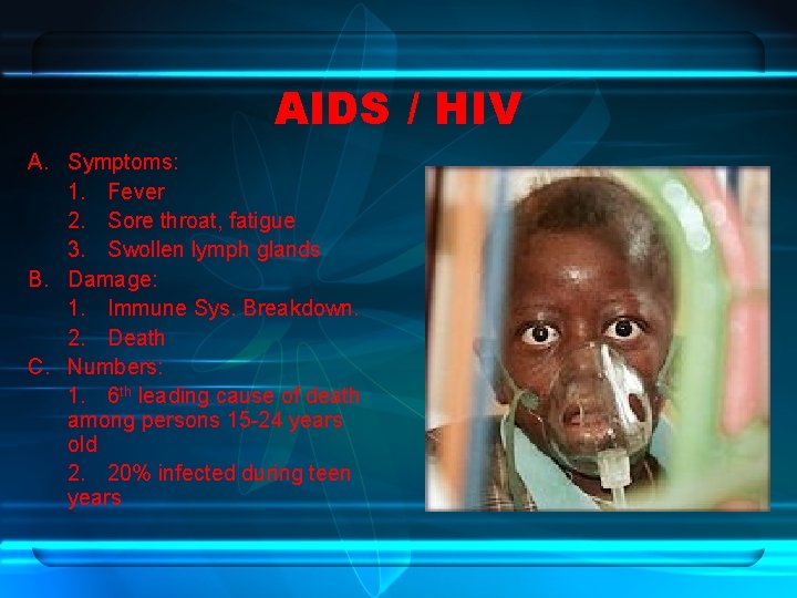 AIDS / HIV A. Symptoms: 1. Fever 2. Sore throat, fatigue 3. Swollen lymph