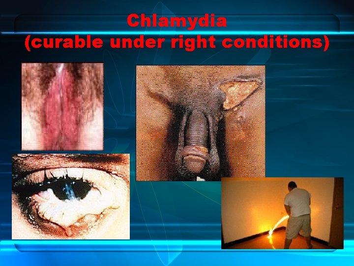 Chlamydia (curable under right conditions) 