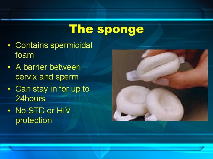 The sponge • Contains spermicidal foam • A barrier between cervix and sperm •