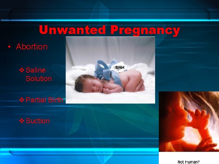 Unwanted Pregnancy • Abortion v. Saline Solution v. Partial Birth v. Suction SHH 