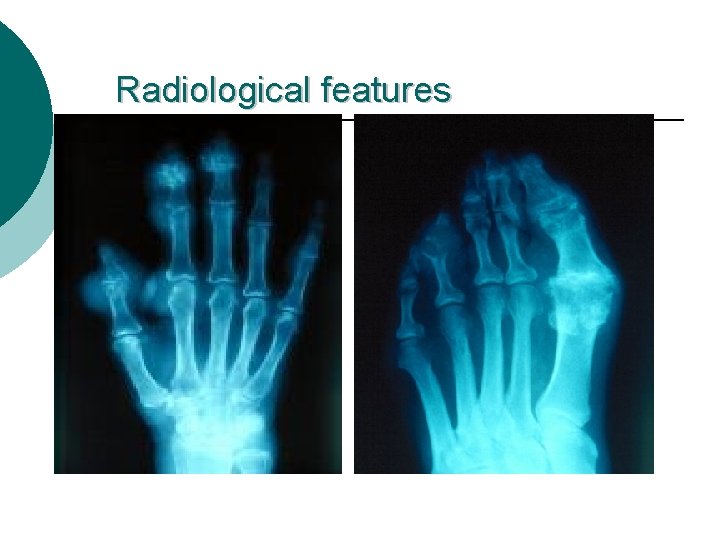 Radiological features 