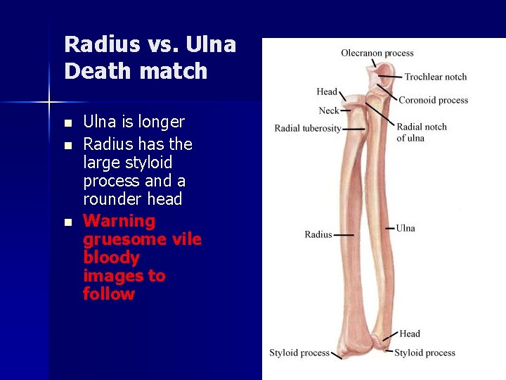 Radius vs. Ulna Death match n n n Ulna is longer Radius has the