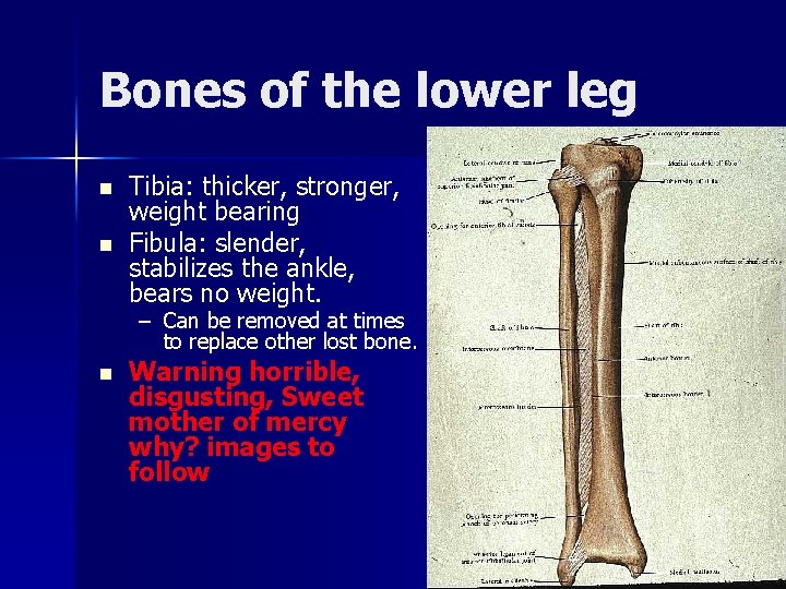 Bones of the lower leg n n Tibia: thicker, stronger, weight bearing Fibula: slender,