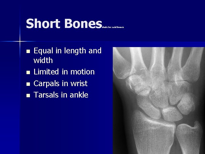 Short Bones dude he said bones n n Equal in length and width Limited