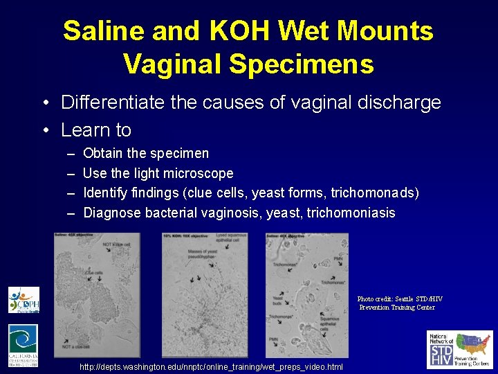 Saline and KOH Wet Mounts Vaginal Specimens • Differentiate the causes of vaginal discharge