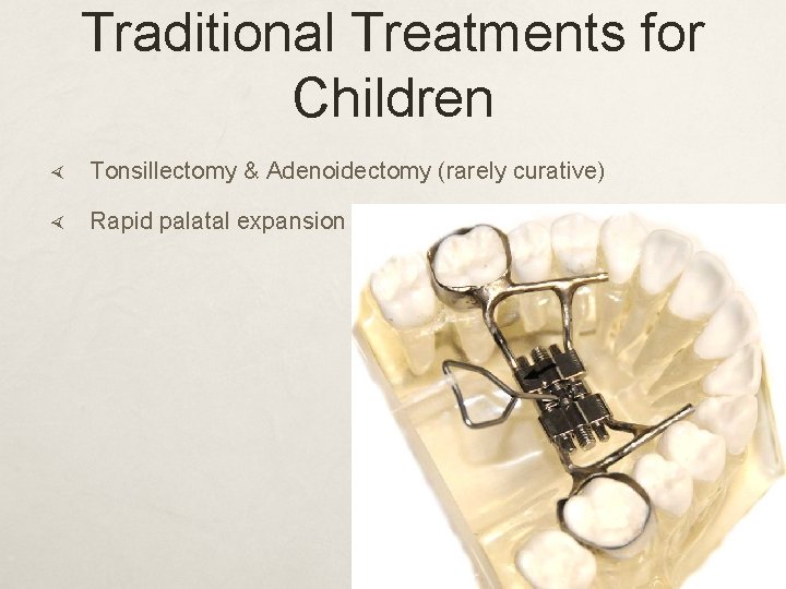 Traditional Treatments for Children Tonsillectomy & Adenoidectomy (rarely curative) Rapid palatal expansion 