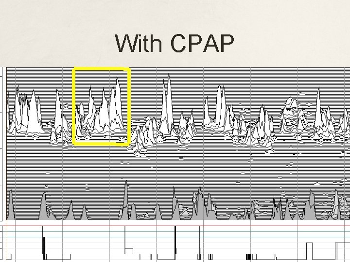With CPAP 
