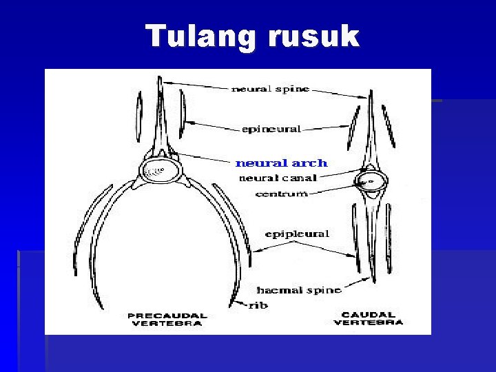 Tulang rusuk 